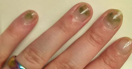 Why Are My Nails Green After Press-Ons? Causes, Fixes & At-Home Nail Care Routine