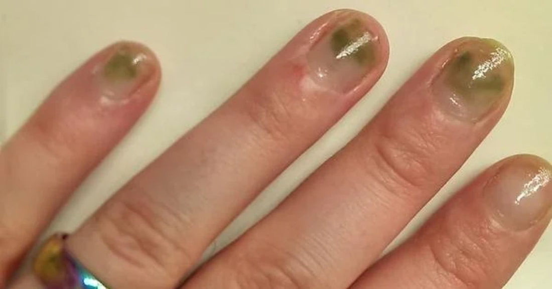 Why Are My Nails Green After Press-Ons? Causes, Fixes & At-Home Nail Care Routine